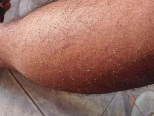 Imagem ou Vídeo