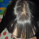 Imagem ou Vídeo