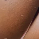 Imagem ou Vídeo