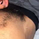 Imagem ou Vídeo