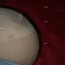 Imagem ou Vídeo