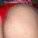 Imagem ou Vídeo