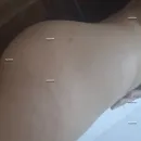 Imagem ou Vídeo