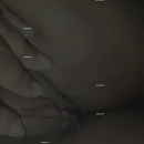 Imagem ou Vídeo