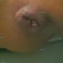 Foto de Lactante fetiches: Prolaps