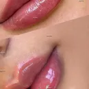 Foto de Laura