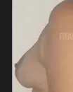 Imagem ou Vídeo